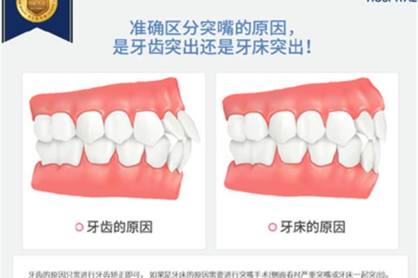 牙齒矯正牙齦突出(矯正牙齦突出要多少錢)