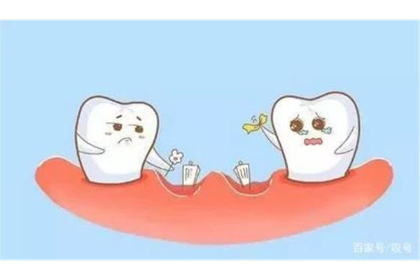 牙周病牙齒脫落